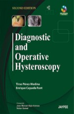 Diagnostic and Operative Hysteroscopy 2nd Edition