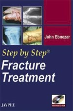 Step by Step Fracture Treatment with Photo CD-ROM 1st Edition