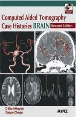  COMPUTED AIDED TOMOGRAPHY CASE HISTORIES BRAIN WITH CD-ROM 2nd Edition