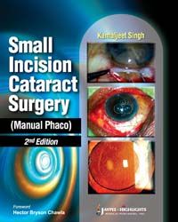 Small Incision Cataract Surgery ( Manual Phaco) 1/e 2002