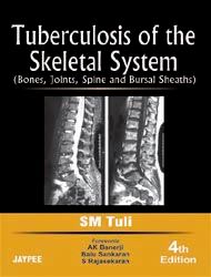 Tuberculosis Of The Skeletal System, 3rd Edi. 2004