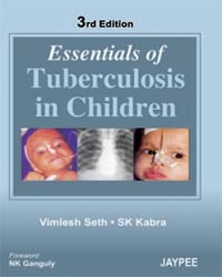 Ess. Of Tuberculosis In Children 3/e