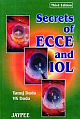 Secrets Of Ecce And Iol 3rd Edition 