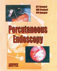 Percutaneous Endoscopy, 2001