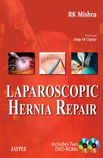 Laparoscopic Hernia Repair 