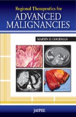 Regional Therapeutics for Advances Malignancies 