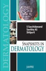 Snapshots in Dermatology 1st Edition