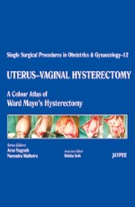 Uterus-Vaginal Hysterectomy: A Colour Atlas of Ward Mayo`s Hysterectomy 1st Edition