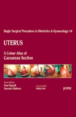 Uterus: A Colour Atlas of Caesarean Section 1st Edition