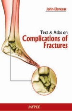 Text and Atlas of Complications of Fractures 