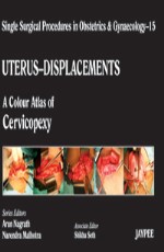 Uterus-Displacements: A Colour Atlas of Cervicopexy 1st Edition