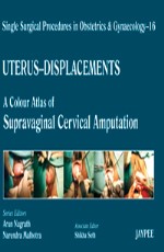 Single Surgical Procedures in Obstetrics and Gynaecology-16: A Colour Atlas of Supravaginal Cervical Amputation (Nadkarni\`s) 1st Edition
