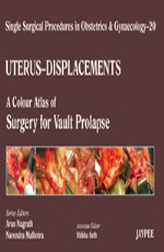 Single Surgical Procedures in Obstetrics and Gynaecology???20: A Colour Atlas of Surgery for Vault Prolapse 1st Edition