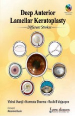 Deep Anterior Lamellar Keratoplasty Different Strokes (With DVD) 1st Edition 