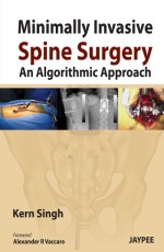 Minimally Invasive Spine Surgery: An Algorithmic Approach 1st Edition 