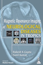 MAGNETIC RESONANCE IMAGING OF NEUROLOGICAL DISEASES IN TROPICS