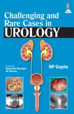 CHALLENGING AND RARE CASES IN UROLOGY