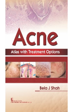 ACNE ATLAS WITH TREATMENT OPTIONS (HB 2018)