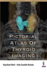 Pictorial Atlas Of Thyroid Imaging