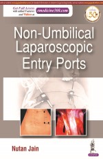 Non-Umbilical Laparoscopic Entry Ports