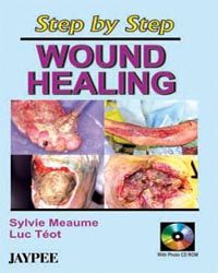Step By Step Wound Healing, 2005(With CD)