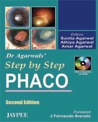 Step By Step Phaco ,with 2 Interactive CD ROMs, 2005