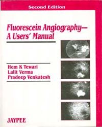 Fluorescein Angiography- A User`s Manual, 2nd Edi. 2003