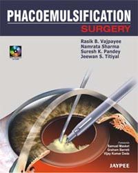 Phacoemulsification Surgery: A Practical Manual (with CD -Rom) (Full Colour) 