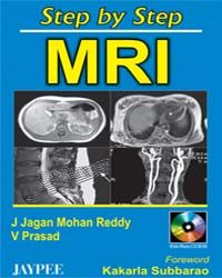 Step By Step MRI, with CD, 2005