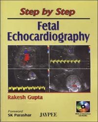 Step By Step Fetal Echocardiography with CD, 2006