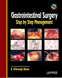 Gastrointestinal Surgery: Step By Step Management, 2005