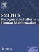 Smith`s Recognizable Patterns of Human Malformation