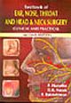 Textbook of Ear, Nose, Throat and Head & Neck Surgery(Theory, Clinical & Practical)
