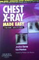 Chest X-Ray Made Easy 3rd Ed.