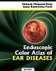 Endoscopic Color Atlas Of Ear Diseases