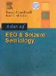 Atlas of EEG & Seizure Semiology 