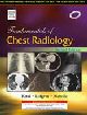 Fundamentals of Chest Radiology, 2/e 