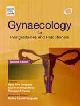 Gynaecology for Postgraduate and Practitioners, 2/e