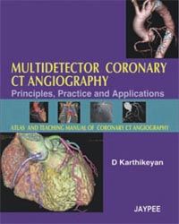 Multidetector Coronary CT Angiography: Principles, Practice and Applications 1st Edition