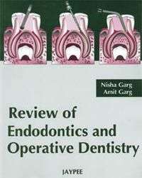 Review of Endodontics and Operative Dentistry 1st Edition