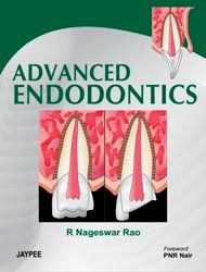 Advanced Endodontics