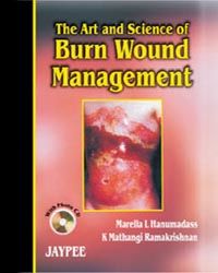 The Art and Science of Burn Wound Management with Photo CD-ROM 
