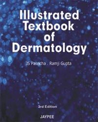 Illustrated Textbook of Dermatology