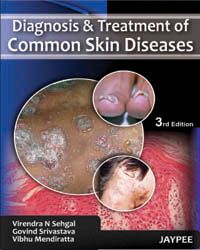 Diagnosis and Treatment of Common Skin Diseases