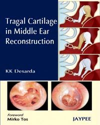 Tragal Cartilage in Middle Ear Reconstruction