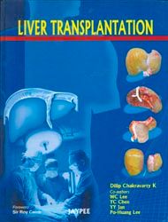 Liver Transplantation