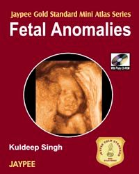 		 	 Jaypee Gold Standard Mini Atlas Series Fetal Anomalies with Photo CD-ROM