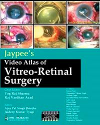 Jaypee`s Video Atlas of Vitreo-Retinal Surgery with 12 DVD-ROMs 