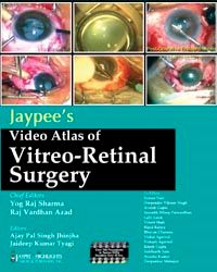 Jaypee`s Video Atlas of Vitreo-Retinal Surgery with 12 DVD-ROMs 