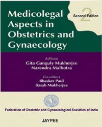 MEDICOLEGAL ASPECTS IN OBSTETRICS AND GYNECOLOGY /2ND EDN. 2 Rev ed Edition